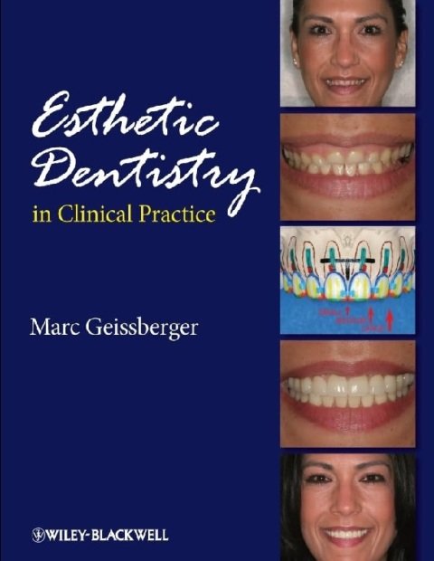 Esthetic Dentistry in Clinical Practice.