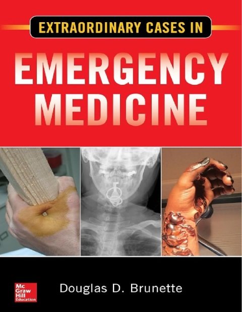 Extraordinary Cases in Emergency Medicine.