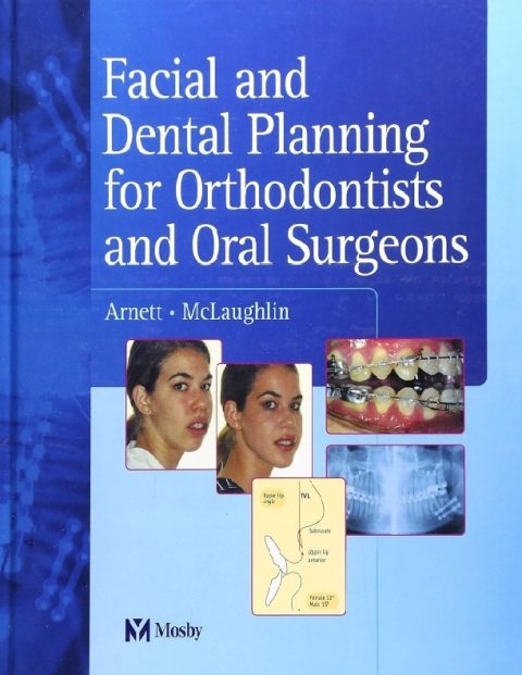 Facial and Dental Planning for Orthodontists and Oral Surgeons.