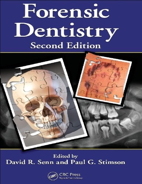 Forensic Dentistry.