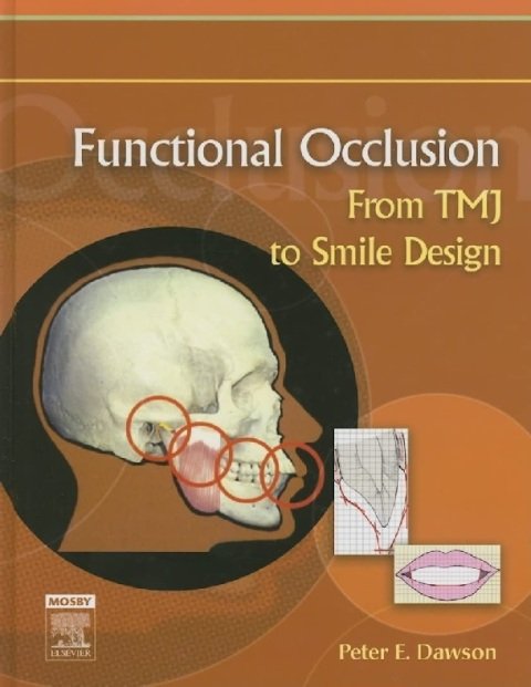 Functional Occlusion From TMJ to Smile Design.
