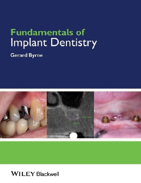 Fundamentals of Implant Dentistry.