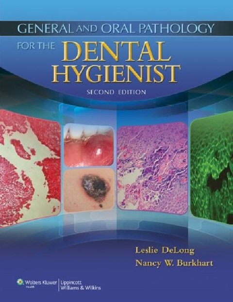 General and Oral Pathology for the Dental Hygienist.