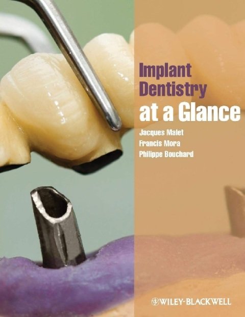 Implant Dentistry at a Glance.