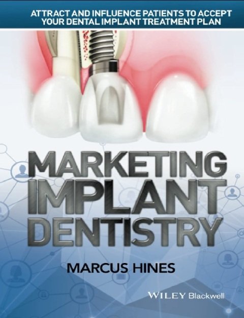 Marketing Implant Dentistry Attract and Influence Patients to Accept Your Dental Implant Treatment Plan.