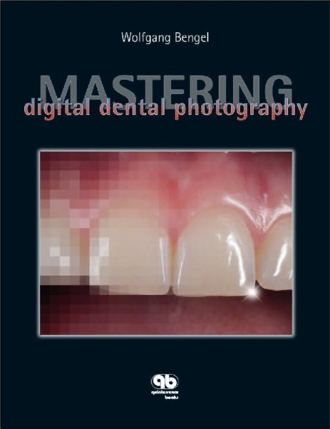 Mastering Digital Dental Photography.