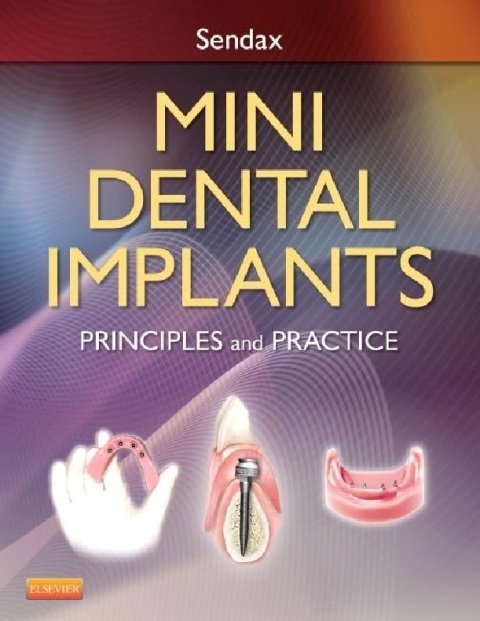 Mini Dental Implants Principles and Practice.