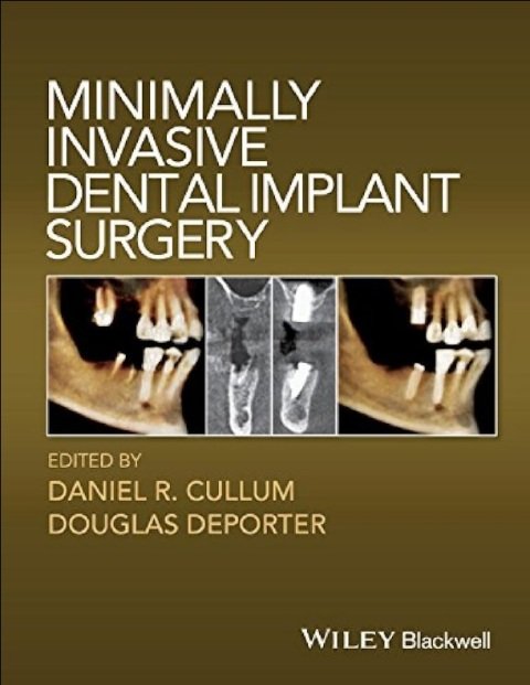 Minimally Invasive Dental Implant Surgery.