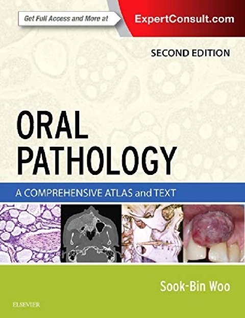 Oral Pathology A Comprehensive Atlas and Text.
