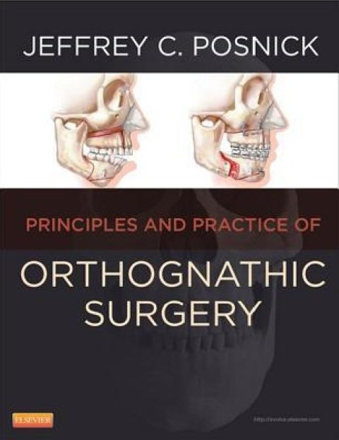 Orthognathic Surgery - 2 Volume Set Principles and Practice, 1e.