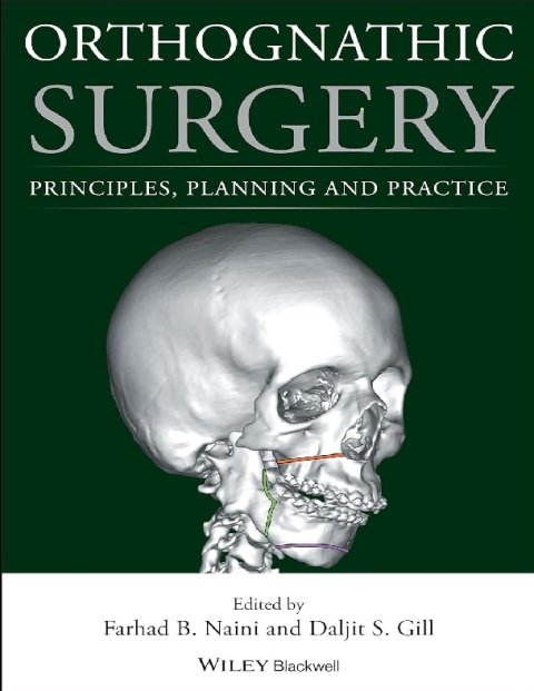 Orthognathic Surgery Principles, Planning and Practice.