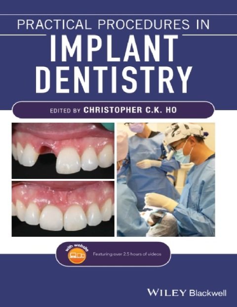 Practical Procedures in Implant Dentistry.