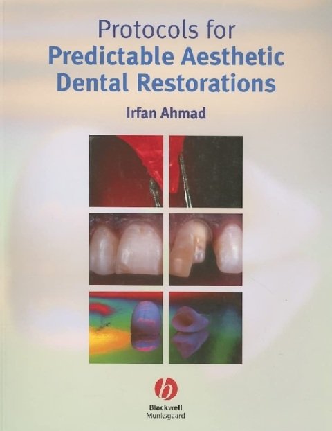 Protocols for Predictable Aesthetic Dental Restorations.