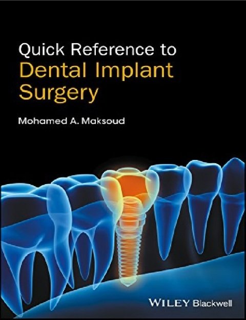 Quick Reference to Dental Implant Surgery.