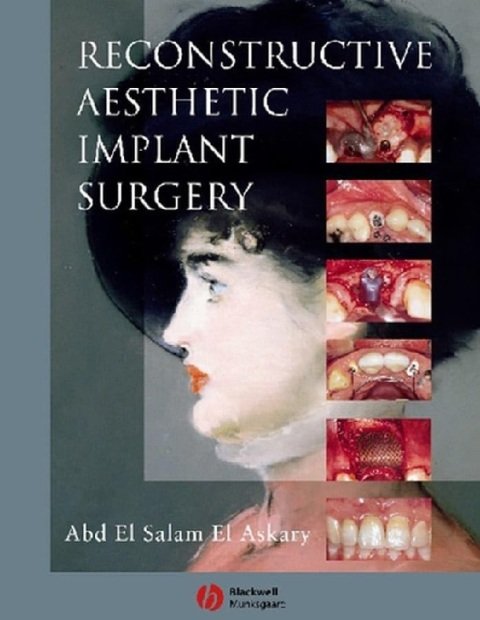 Reconstructive Aesthetic Implant Surgery.