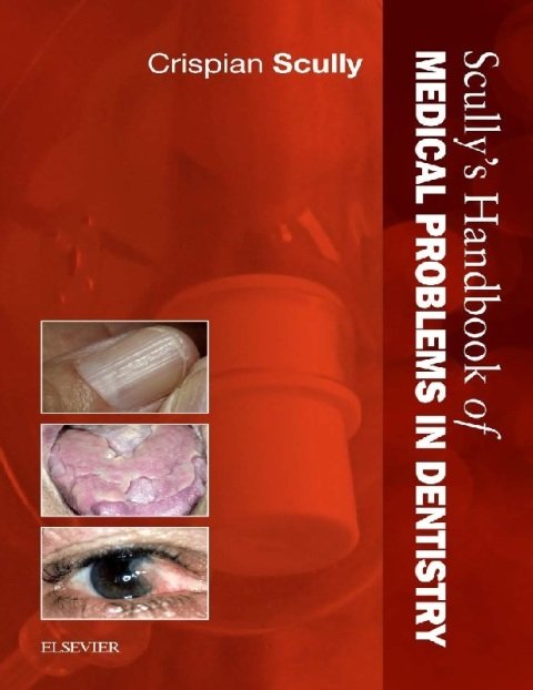 Scully's Handbook of Medical Problems in Dentistry.