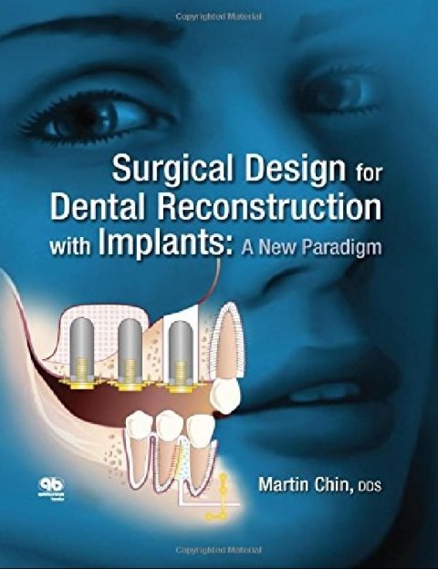 Surgical Design for Dental Reconstruction With Implants A New Paradigm.