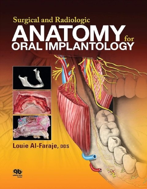 Surgical and Radiologic Anatomy of Oral Implantology.