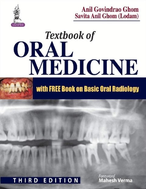 Textbook of Oral Medicine.