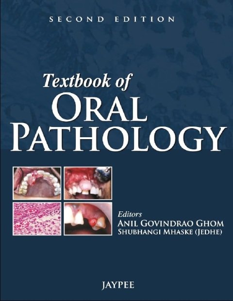 Textbook of Oral Pathology.