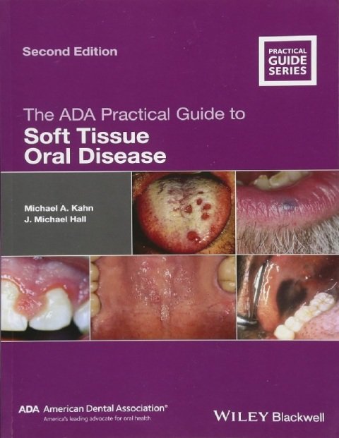 The ADA Practical Guide to Soft Tissue Oral Disease.