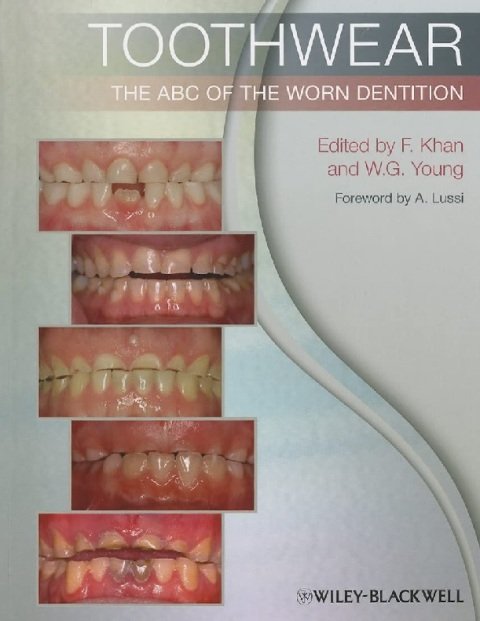 Toothwear The ABC of the Worn Dentition.