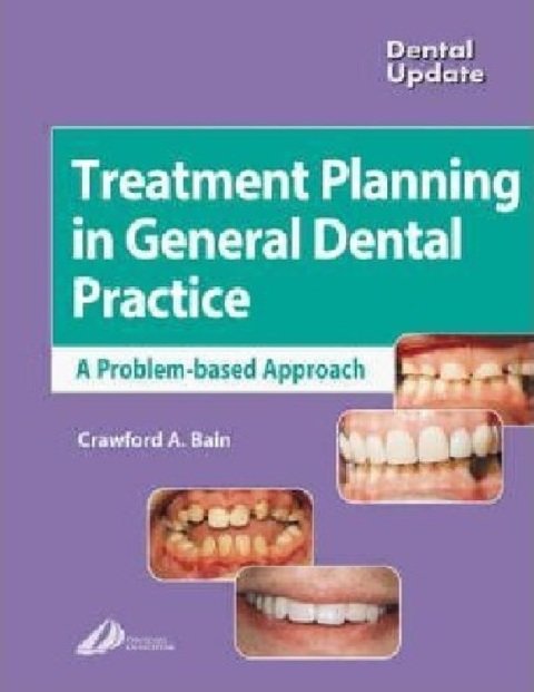 Treatment Planning in General Dental Practice (Dental Update).