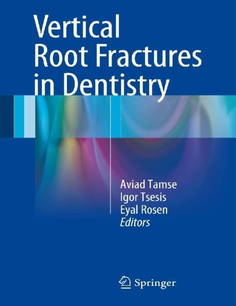 Vertical Root Fractures in Dentistry.
