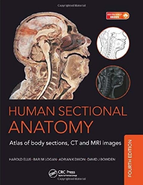 Human Sectional Anatomy Pocket Atlas Of Body Sections CT and MRI images 4th Edition.