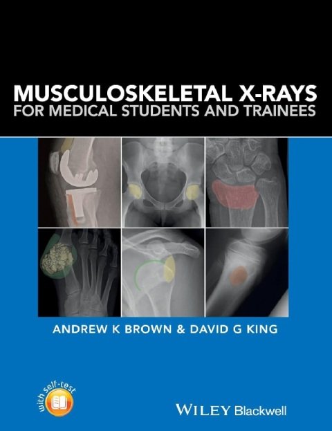 Musculoskeletal X-Rays for Medical Students and Trainees 1st Edition.