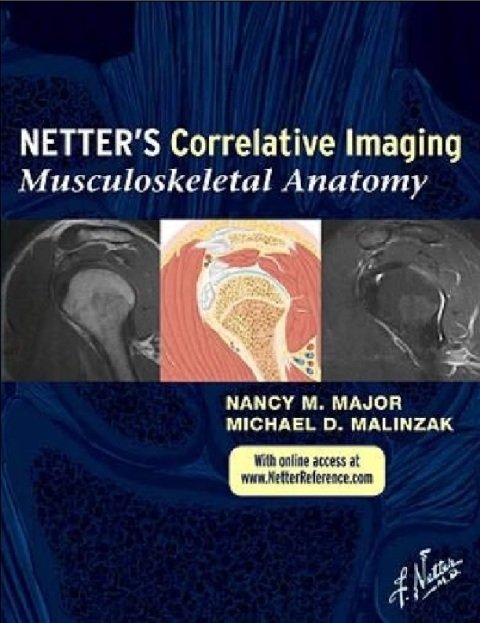 Netter's Correlative Imaging Musculoskeletal Anatomy.