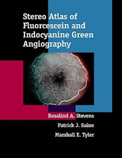 Stereo Atlas of Fluorescein and Indocyanine Green Angiography.