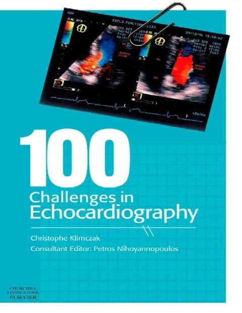 100 Challenges in Echocardiography.