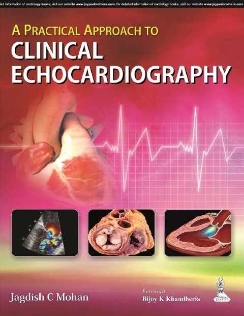 A Practical Approach to Clinical Echocardiography.