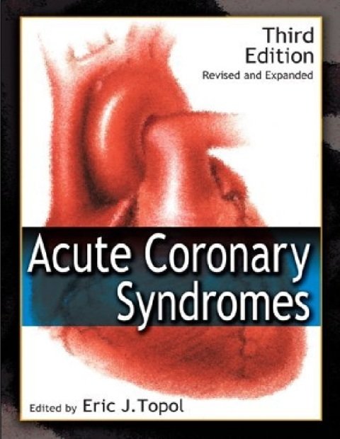 Acute Coronary Syndromes, Third Edition (Fundamental and Clinical Cardiology Book 55).