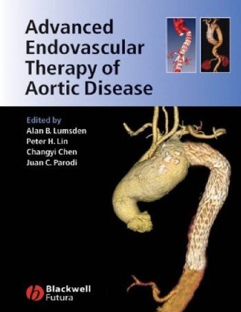 Advanced Endovascular Therapy of Aortic Disease.