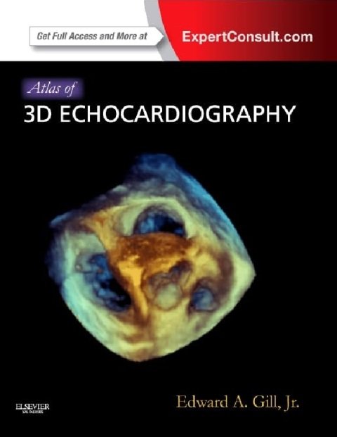 Atlas of 3D Echocardiography Expert Consult – Online and Print.