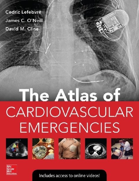 Atlas of Cardiovascular Emergencies.