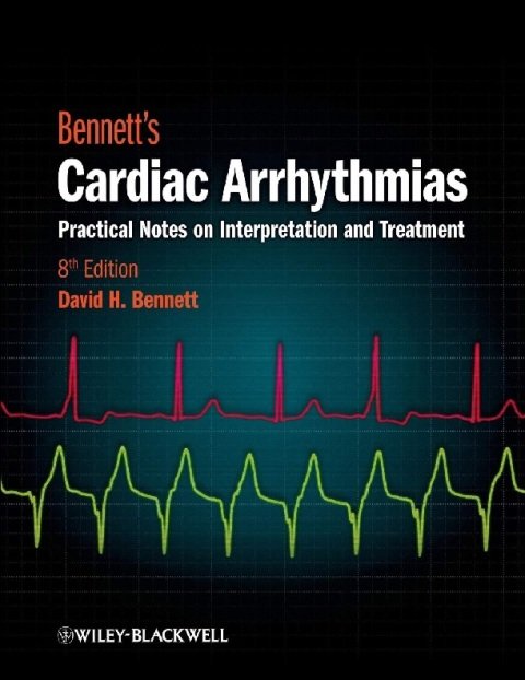 Bennett's Cardiac Arrhythmias Practical Notes on Interpretation and Treatment.