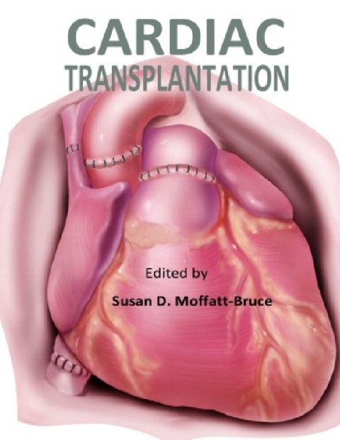 Cardiac Transplantation.