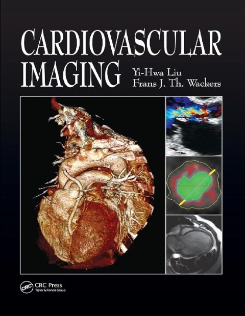 Cardiovascular Imaging.