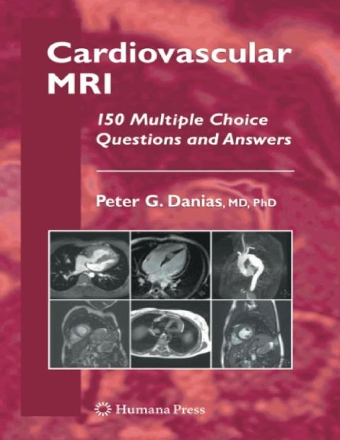 Cardiovascular MRI 150 Multiple-Choice Questions and Answers (Contemporary Cardiology).
