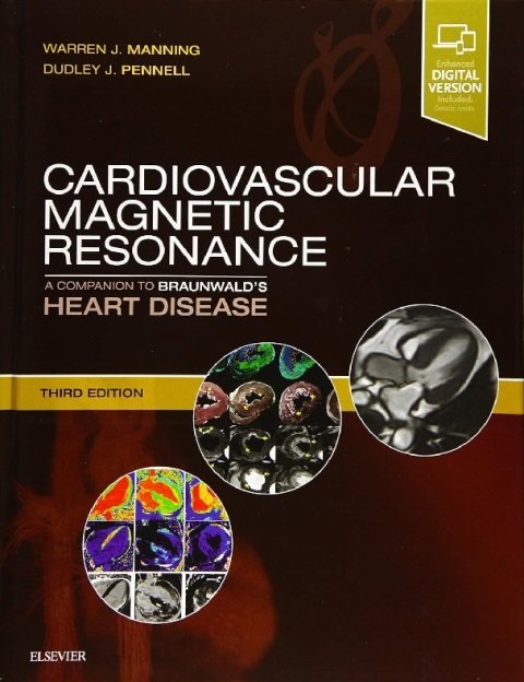 Cardiovascular Magnetic Resonance A Companion to Braunwald’s Heart Disease.