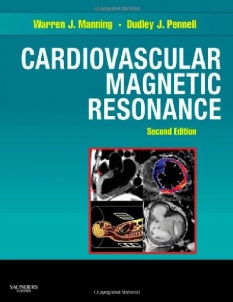 Cardiovascular Magnetic Resonance (Companion to Braunwald's Heart Disease).