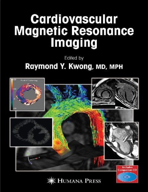 Cardiovascular Magnetic Resonance Imaging (Contemporary Cardiology).