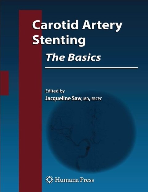 Carotid Artery Stenting The Basics (Contemporary Cardiology).