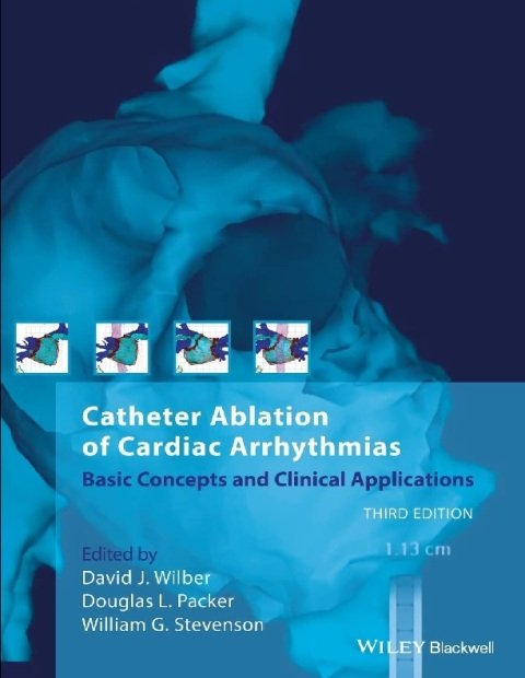 Catheter Ablation of Cardiac Arrhythmias.