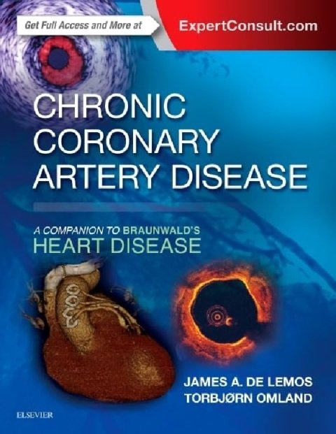 Chronic Coronary Artery Disease A Companion to Braunwald's Heart Disease.