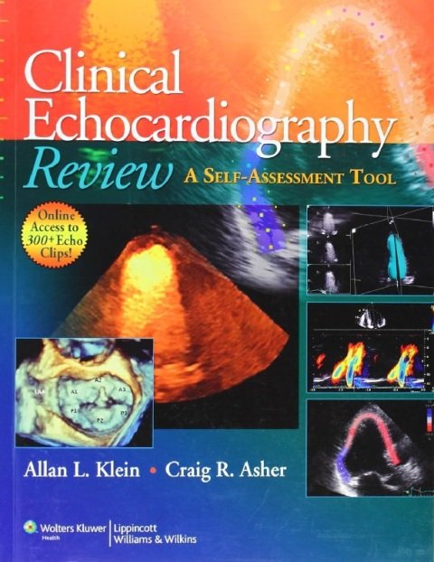 Clinical Echocardiography Review A Self-Assessment Tool.