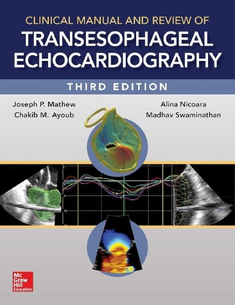 Clinical Manual and Review of Transesophageal Echocardiography, 3e.